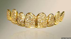 Hukum Menggunakan Emas Sebagai Gigi Palsu